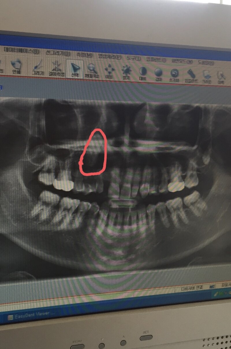 다리다리 분석과 실시간패턴통계