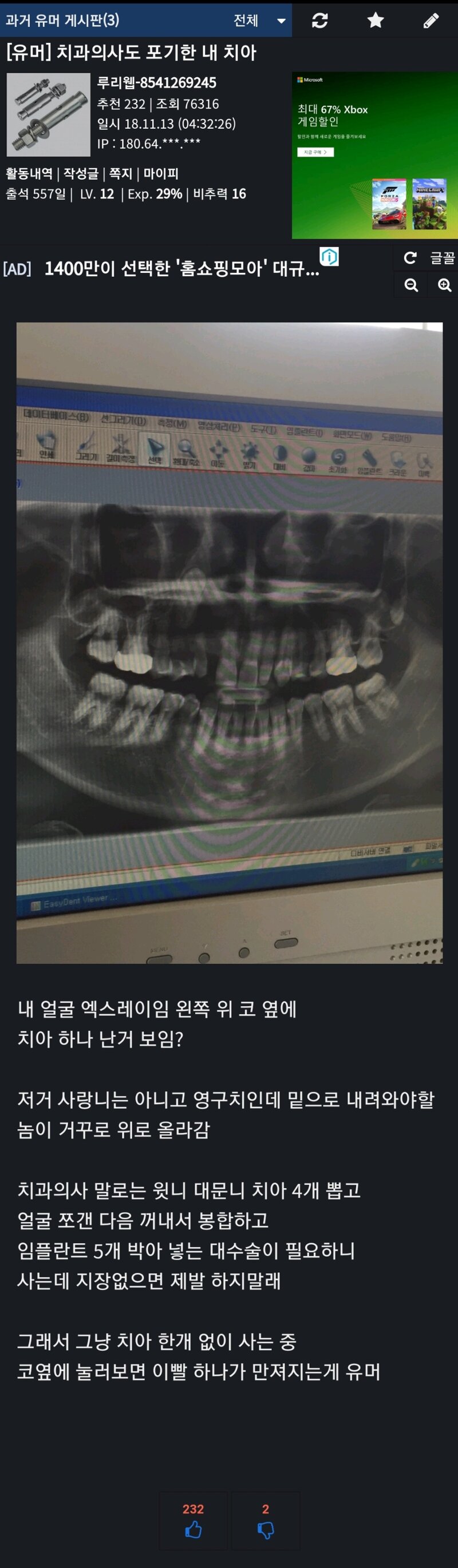 달팽이 분석과 실시간패턴통계