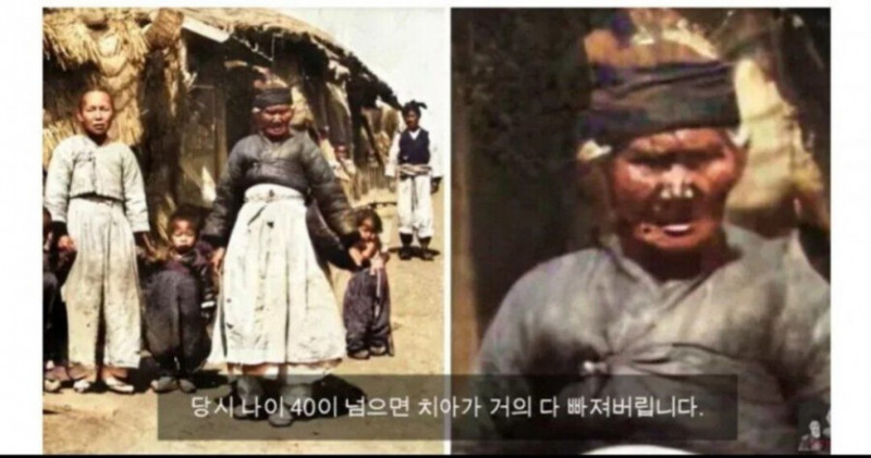 달팽이게임분석기