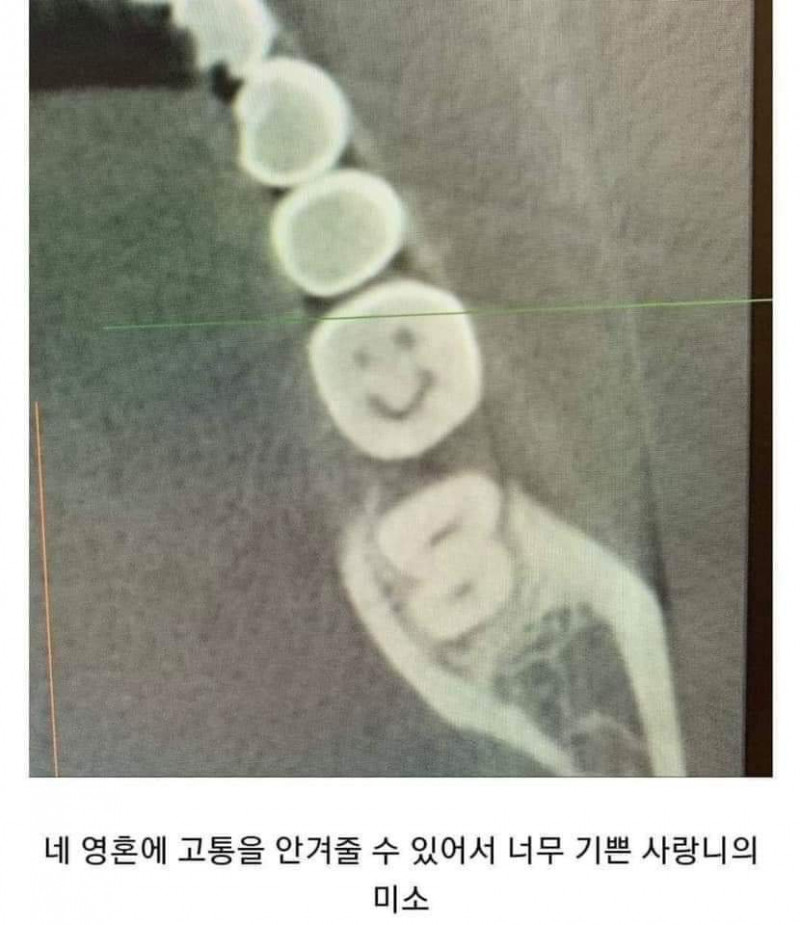 달팽이게임분석