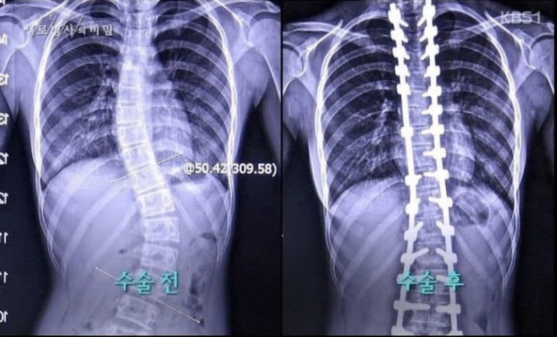 달팽이게임통계