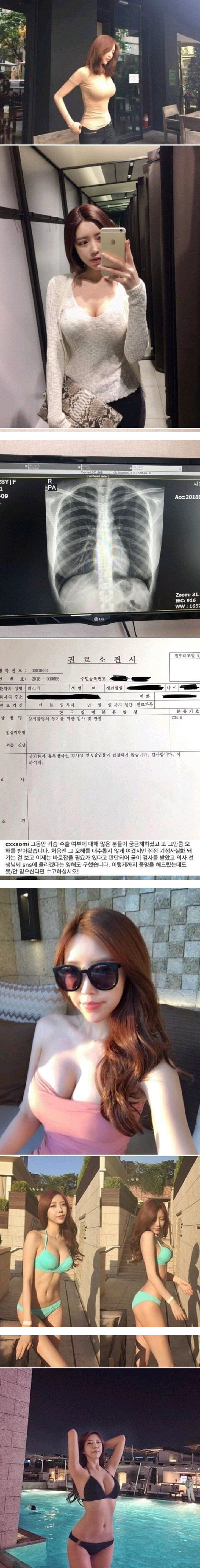 달팽이게임픽