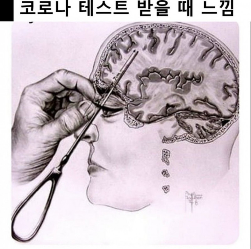 달팽이게임분석