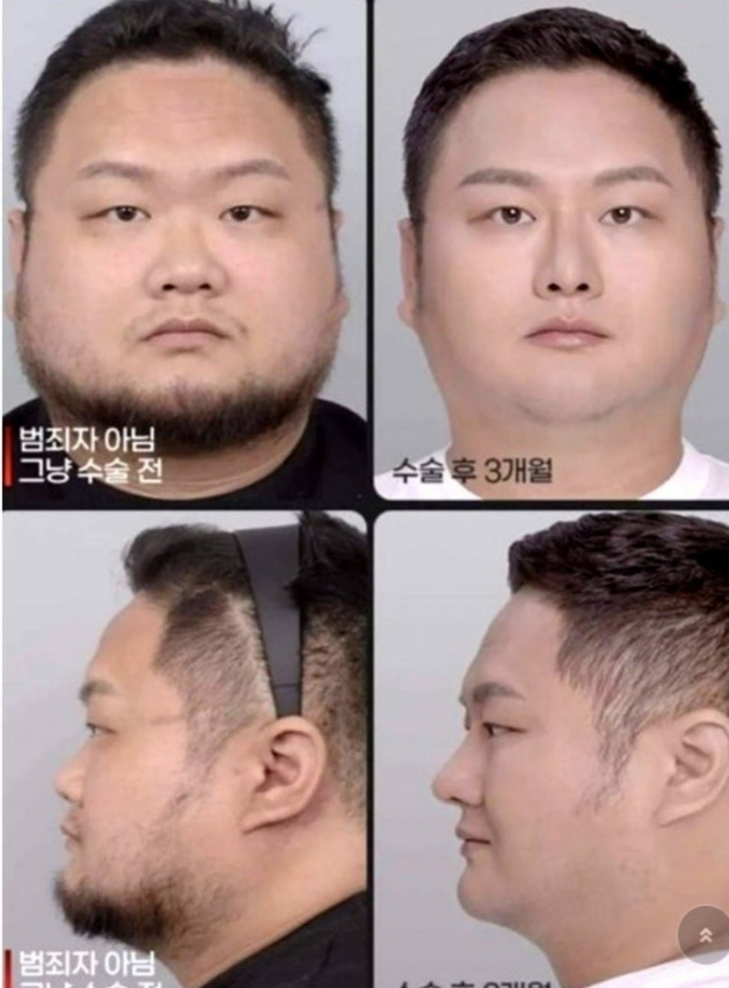 달팽이게임