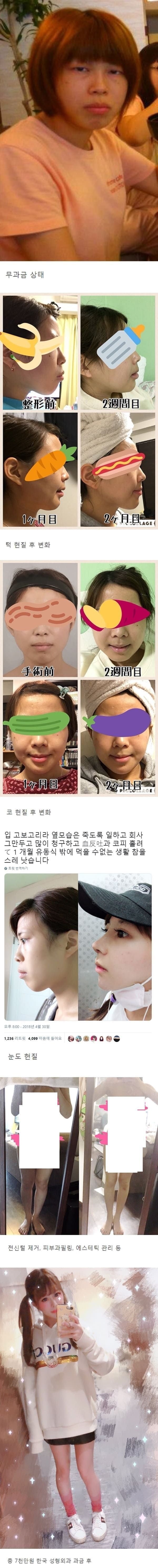 사다리게임분석기