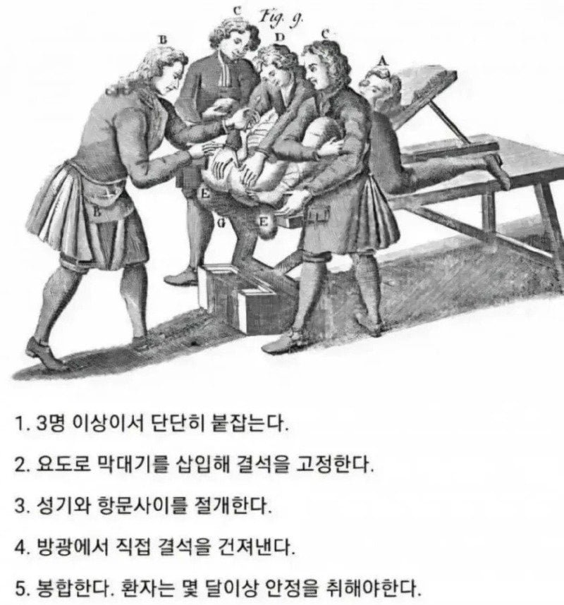 사다리게임분석