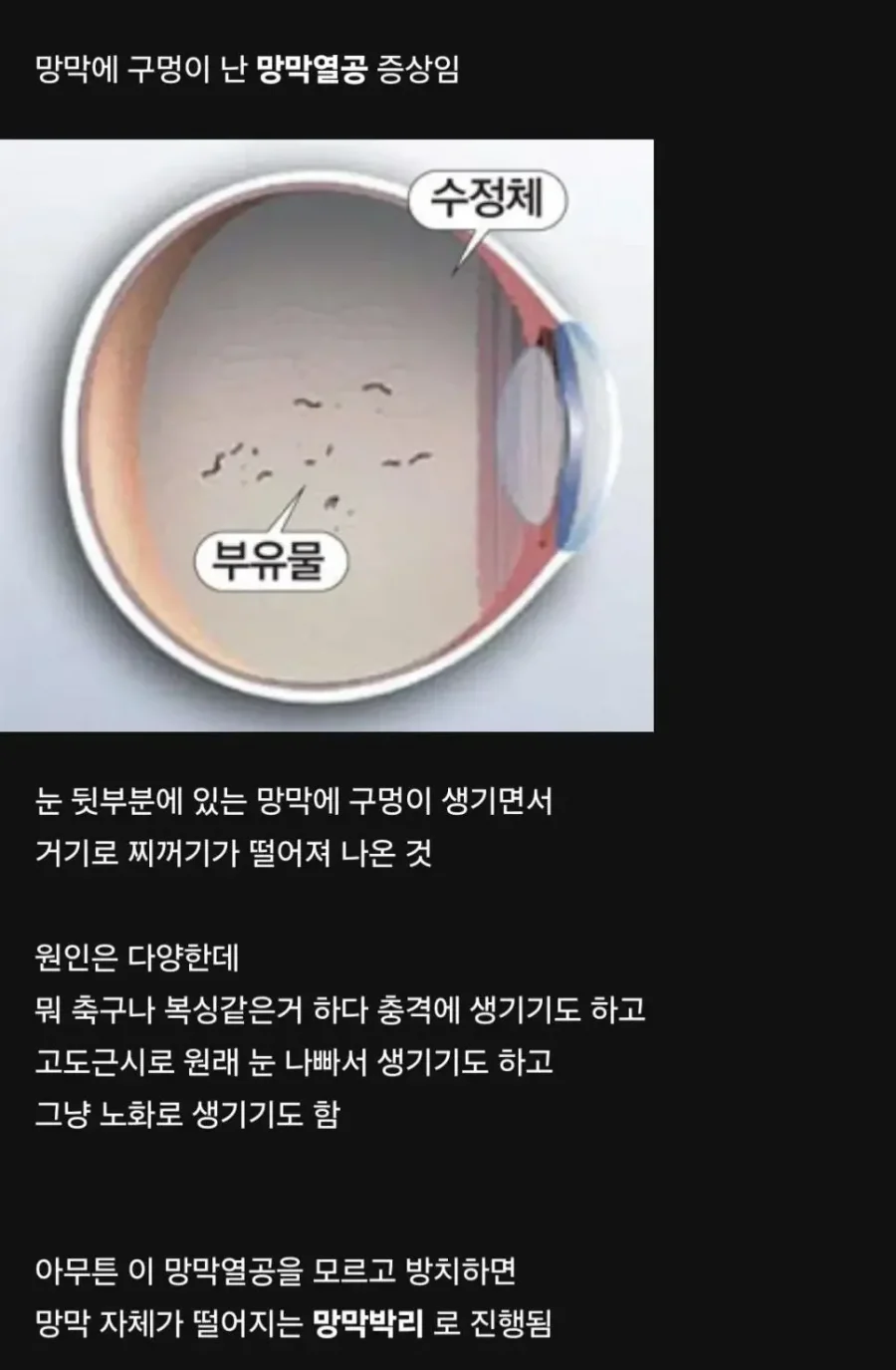 달팽이게임분석기