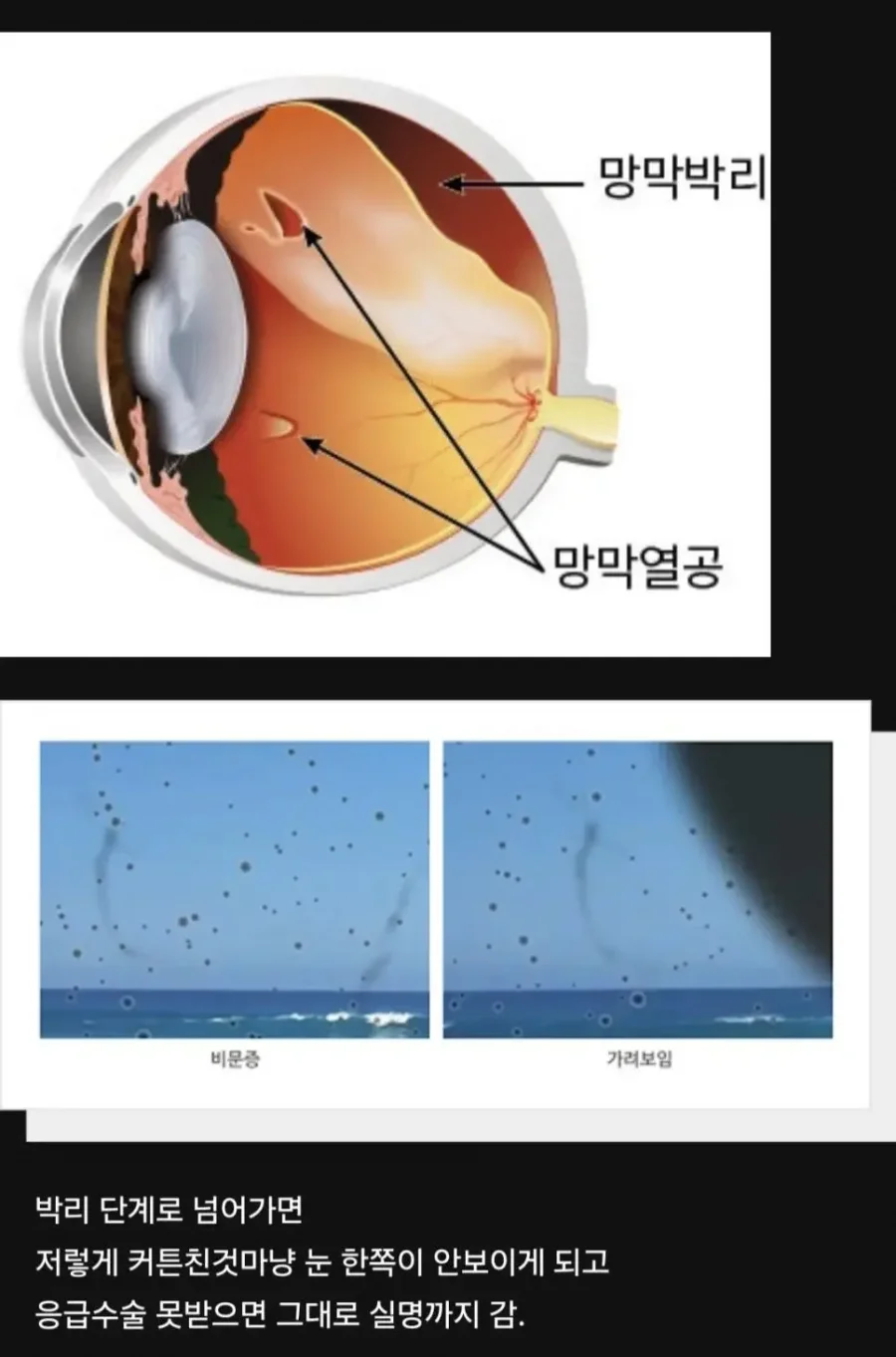 달팽이게임픽분석