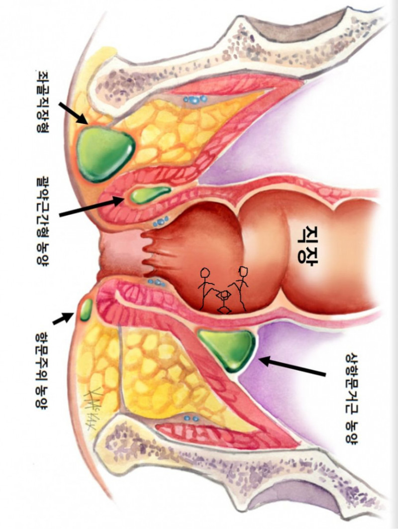 사다리게임