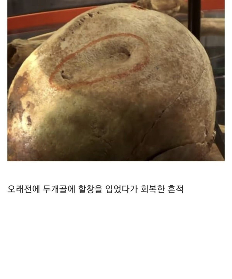 달팽이게임픽